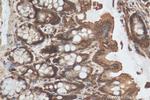 CCDC18 Antibody in Immunohistochemistry (Paraffin) (IHC (P))