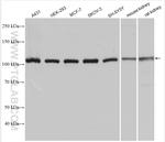 AP2A1 Antibody in Western Blot (WB)