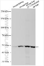 SLC43A2 Antibody in Western Blot (WB)