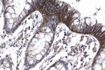 ATP2B1 Antibody in Immunohistochemistry (Paraffin) (IHC (P))