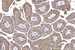 RACGAP1 Antibody in Immunohistochemistry (Paraffin) (IHC (P))