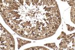 RACGAP1 Antibody in Immunohistochemistry (Paraffin) (IHC (P))