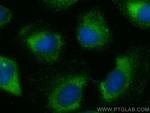 COL12A1 Antibody in Immunocytochemistry (ICC/IF)