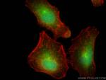 BAHCC1 Antibody in Immunocytochemistry (ICC/IF)