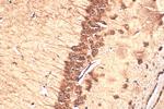 BAHCC1 Antibody in Immunohistochemistry (Paraffin) (IHC (P))