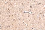BAHCC1 Antibody in Immunohistochemistry (Paraffin) (IHC (P))