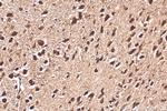 BAHCC1 Antibody in Immunohistochemistry (Paraffin) (IHC (P))