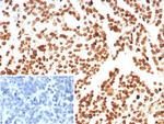 Histone H1 (Pan Nuclear Marker) Monoclonal Antibody (rHH1/8702)