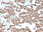 Histone H1 Antibody in Immunohistochemistry (Paraffin) (IHC (P))