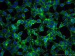 B7-H3 Antibody in Immunocytochemistry (ICC/IF)