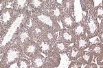 DNAH6 Antibody in Immunohistochemistry (Paraffin) (IHC (P))