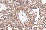 DNAH6 Antibody in Immunohistochemistry (Paraffin) (IHC (P))