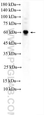 TCF21 Antibody in Western Blot (WB)