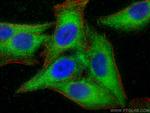 FUCA2 Antibody in Immunocytochemistry (ICC/IF)