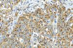 FUCA2 Antibody in Immunohistochemistry (Paraffin) (IHC (P))