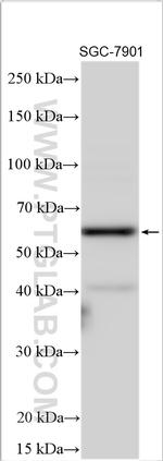 FUCA2 Antibody in Western Blot (WB)