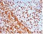 Annexin A1/(Hairy Cell Leukemia Marker) Recombinant Mouse Monoclonal Antibody (rANXA1/6451)