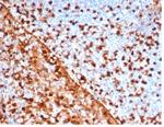 Annexin A1/ (Hairy Cell Leukemia Marker) Monoclonal Antibody (rANXA1/6451)