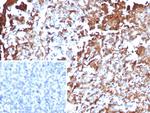 Annexin A1/(Hairy Cell Leukemia Marker) Recombinant Mouse Monoclonal Antibody (rANXA1/6451)