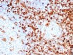 Annexin A1/(Hairy Cell Leukemia Marker) Recombinant Rabbit Monoclonal Antibody (ANXA1/6452R)