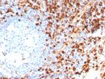 Annexin A1/ (Hairy Cell Leukemia Marker) Recombinant Rabbit Monoclonal Antibody (ANXA1/6452R)