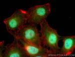 POGZ Antibody in Immunocytochemistry (ICC/IF)