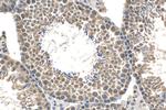 POGZ Antibody in Immunohistochemistry (Paraffin) (IHC (P))