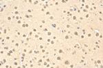 POGZ Antibody in Immunohistochemistry (Paraffin) (IHC (P))