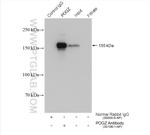 POGZ Antibody in Immunoprecipitation (IP)