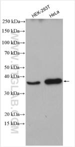 C5orf51 Antibody in Western Blot (WB)