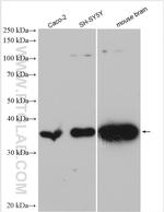 DDAH1 Antibody in Western Blot (WB)