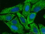 Nlrp3 Antibody in Immunocytochemistry (ICC/IF)