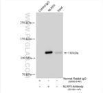 Nlrp3 Antibody in Immunoprecipitation (IP)