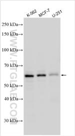 KNOP1 Antibody in Western Blot (WB)