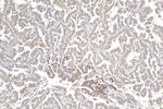 TGFBR1 Antibody in Immunohistochemistry (Paraffin) (IHC (P))