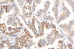 TGFBR1 Antibody in Immunohistochemistry (Paraffin) (IHC (P))