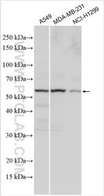 TGFBR1 Antibody in Western Blot (WB)