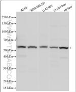TGFBR1 Antibody in Western Blot (WB)