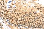 RIF1 Antibody in Immunohistochemistry (Paraffin) (IHC (P))