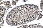 RIF1 Antibody in Immunohistochemistry (Paraffin) (IHC (P))