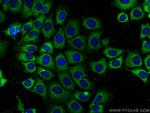 ST3GAL5 Antibody in Immunocytochemistry (ICC/IF)