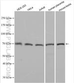 ST3GAL5 Antibody in Western Blot (WB)