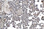 PARP14 Antibody in Immunohistochemistry (Paraffin) (IHC (P))