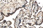 PARP14 Antibody in Immunohistochemistry (Paraffin) (IHC (P))