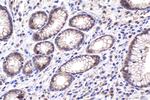 SMAD3 Antibody in Immunohistochemistry (Paraffin) (IHC (P))