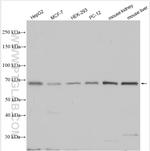 NOX3 Antibody in Western Blot (WB)