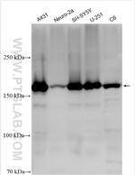 KIAA1797 Antibody in Western Blot (WB)