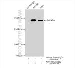 KIF13B Antibody in Immunoprecipitation (IP)