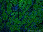LPHN1 Antibody in Immunohistochemistry (Paraffin) (IHC (P))