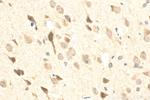 ADCY5 Antibody in Immunohistochemistry (Paraffin) (IHC (P))